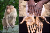 Hơn 16.000 người trên thế giới mắc bệnh đậu mùa khỉ, Bộ Y tế khuyến cáo 6 biện pháp phòng chống