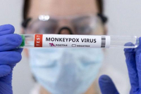 Mỹ thử nghiệm thuốc điều trị đậu mùa khỉ